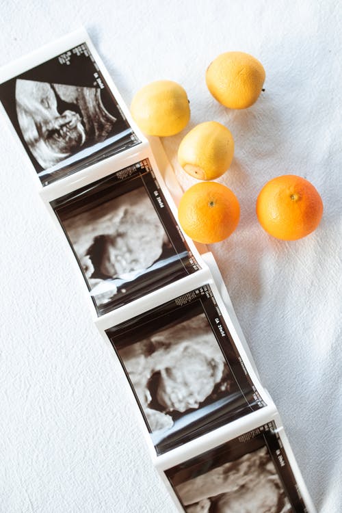 10 MUST-HAVE ITEMS For Your Postpartum Kit
